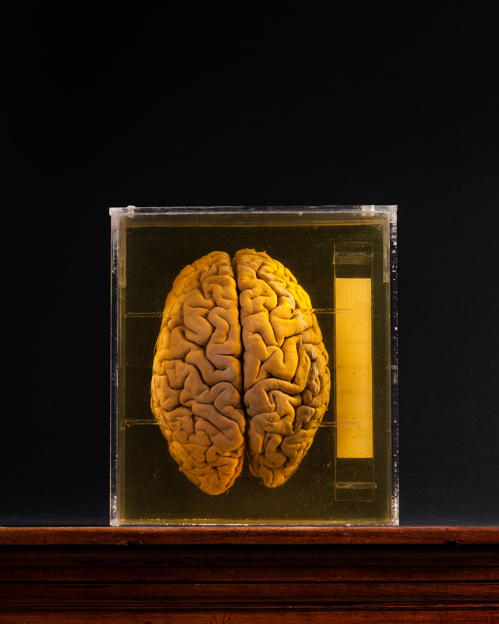 Human Brain